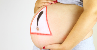 Гестоз: степени тяжести