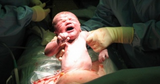 Роды при гестозе