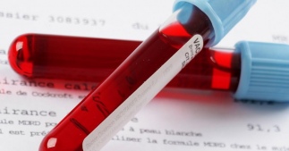 Маркеры преэклампсии