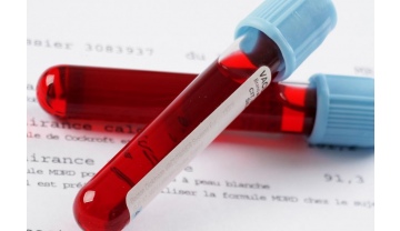 Фото: Маркеры преэклампсии