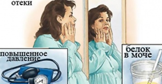 Гестоз средней тяжести