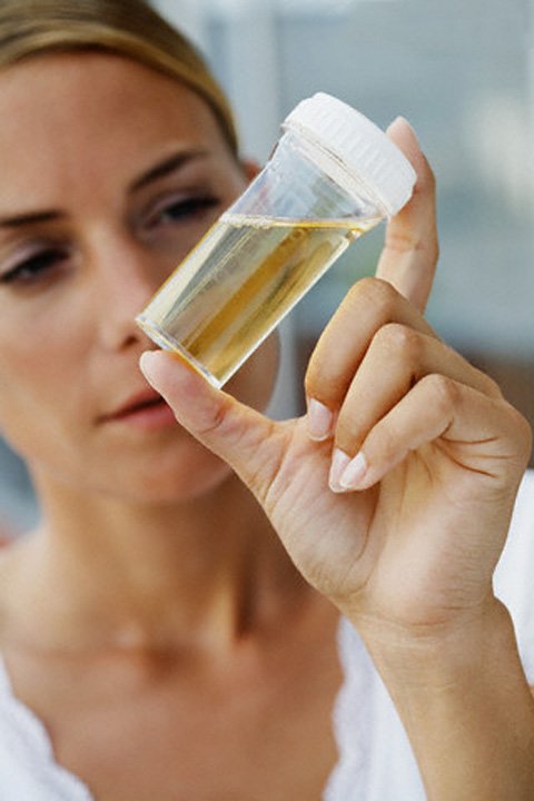 Фото:Гестоз